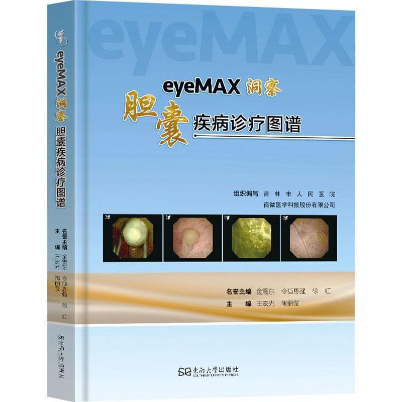 eyeMAX洞察—胆囊疾病诊疗图谱